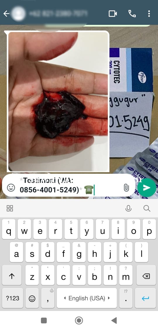 Toko Obat Aborsi Di Makasar 085640015249 Jual Obat Cytotec Asli Dosis 200mg sampai 400mg